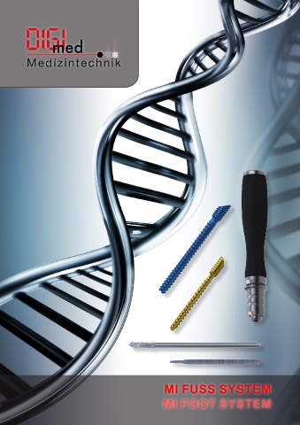 MI Fuss orthopädische Implantat Entfernung MI Fuss orthopädische Implantat Entfernung